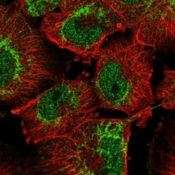 OMA1 Antibody, Novus Biologicals 25 &mu;L, Unlabeled:Antibodies, Polyclonal